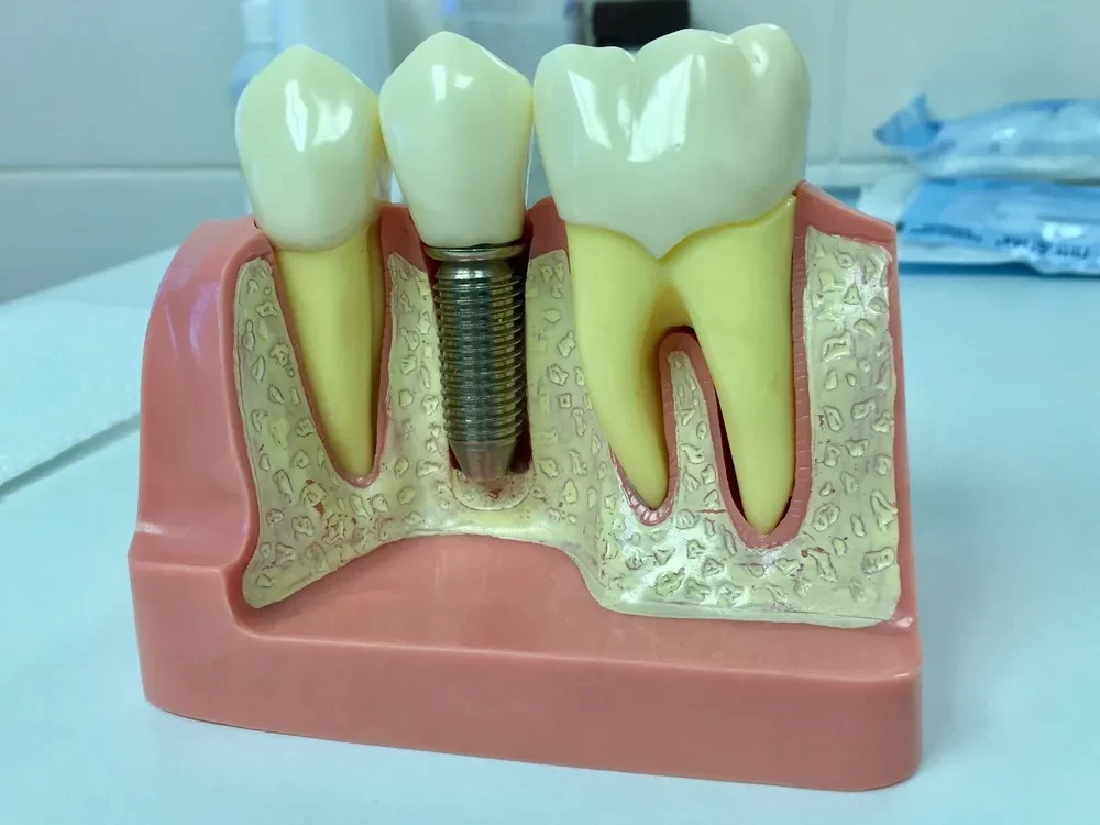 تكاليف دراسة طب الأسنان في مصر للوافدين