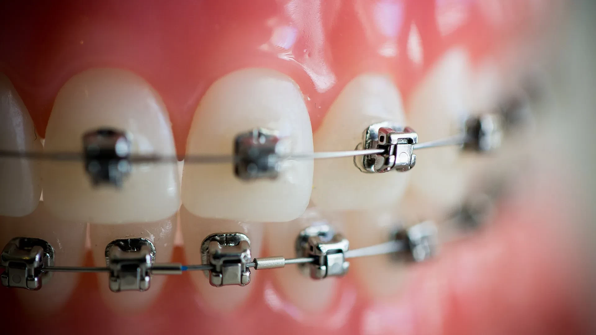 تخصص التقويم في طب الاسنان