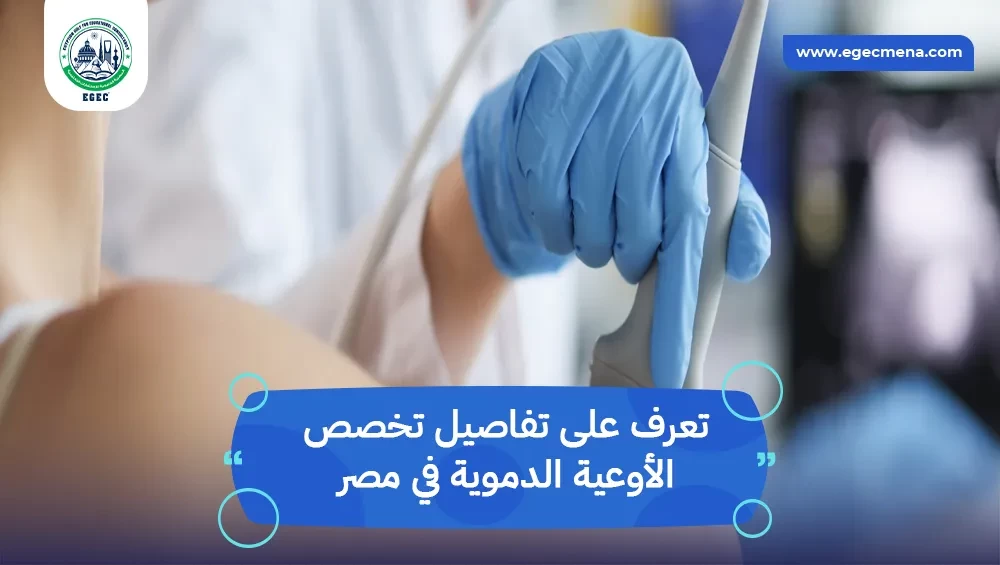 تخصص الأوعية الدموية في مصر